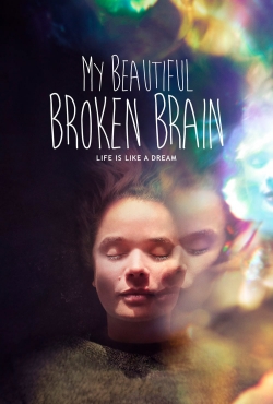 Watch My Beautiful Broken Brain movies free Primewire